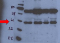 STM | Homeobox protein SHOOT MERISTEMLESS in the group Antibodies Plant/Algal / DNA/RNA/Cell Cycle / Transcription regulation at Agrisera AB (Antibodies for research) (AS11 1764)